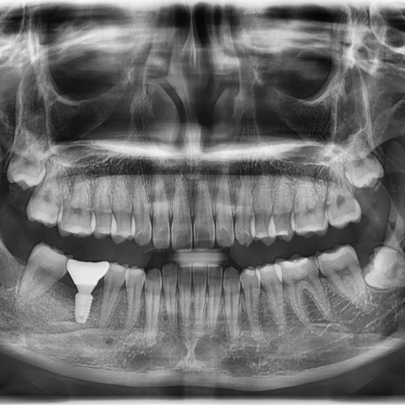 Customer after tooth extraction